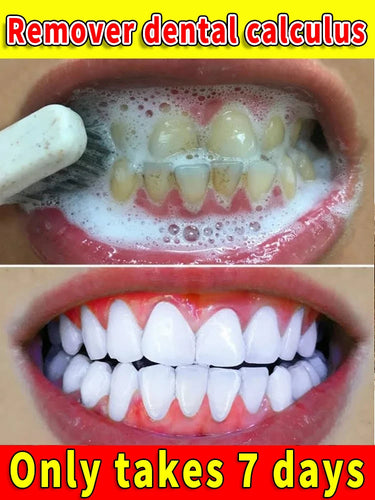 Toothpaste Whitening Tooth Remove  Stains