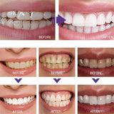 Teeth Cleansing Whitening Toothpaste
