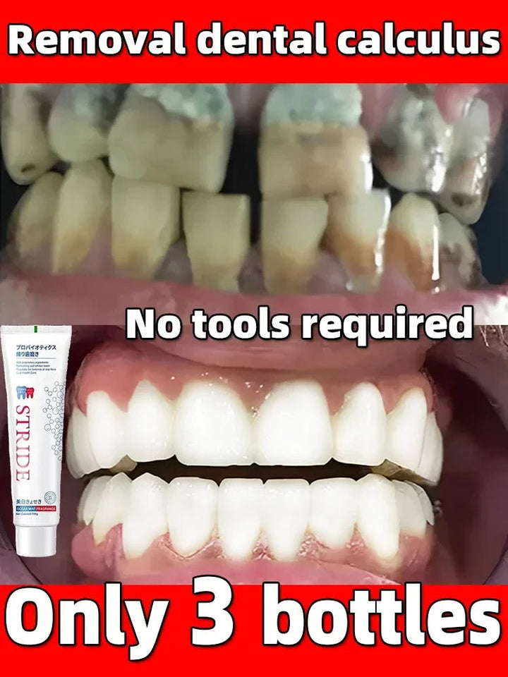 Toothpaste Dental Calculus Remover Whitening