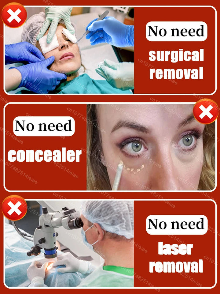 Instantly removes under eye bags,