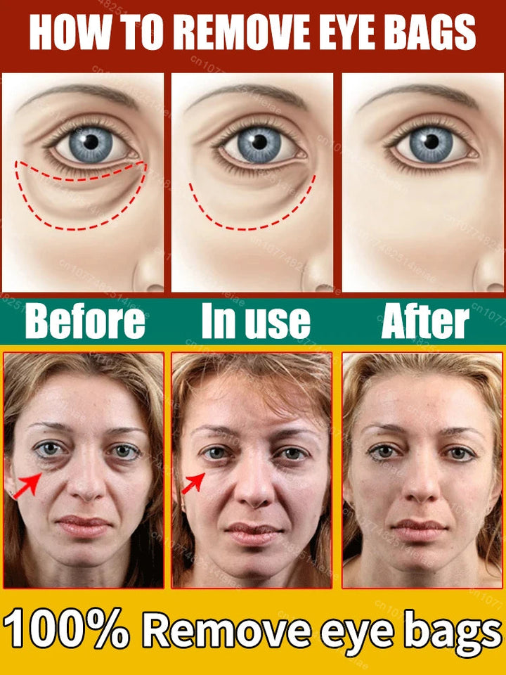 Instantly removes under eye bags,